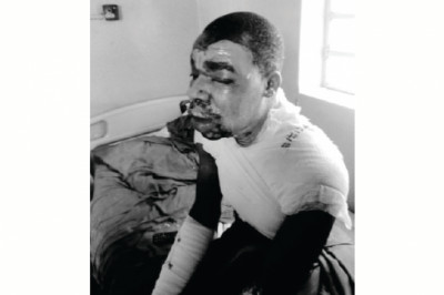 Wife(44) burns hubby(38) with cooking oil, commits suicide in love triangle gone wrong…PICTURES-Zimmagazine